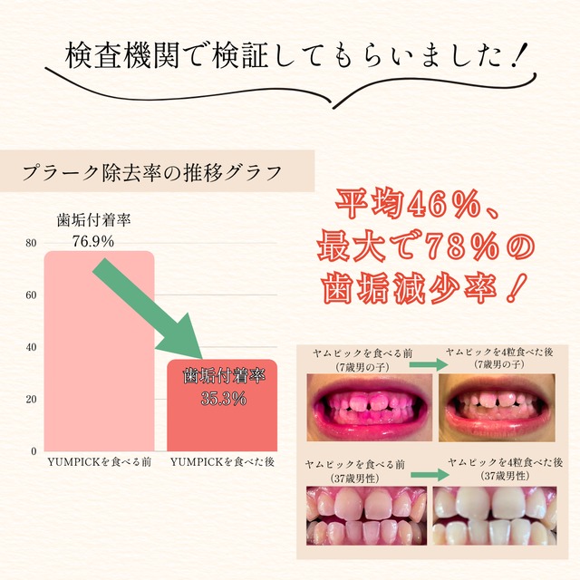 送料無料｜毎月お届け【たっぷり満足定期便】こんにゃくグミヤムピック 10袋