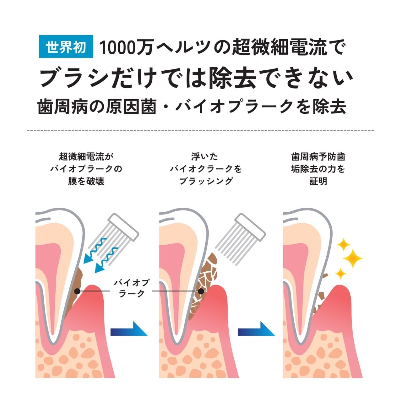 TROMATZ(トロマツ)】バイオカレント歯ブラシ ～最上位モデル 歯周病