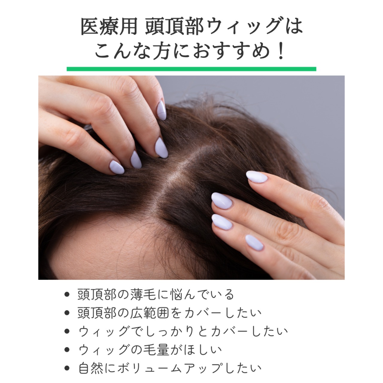 【医療用ウィッグ】 人毛100% 頭頂部カバーウィッグ ミディアムヘア 【13×14cm】|フル卒 部分ウィッグ トップピース 自然に見える 薄毛・白髪しっかりカバー