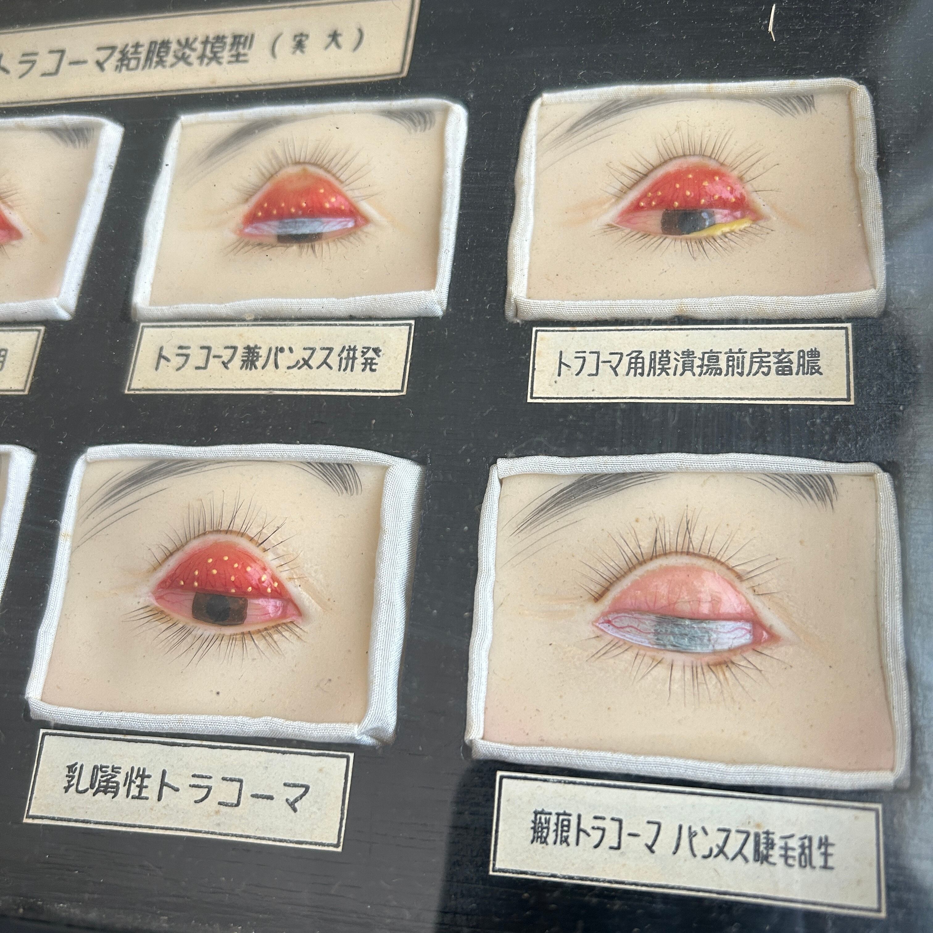 1950年代　眼科用結膜炎模型　