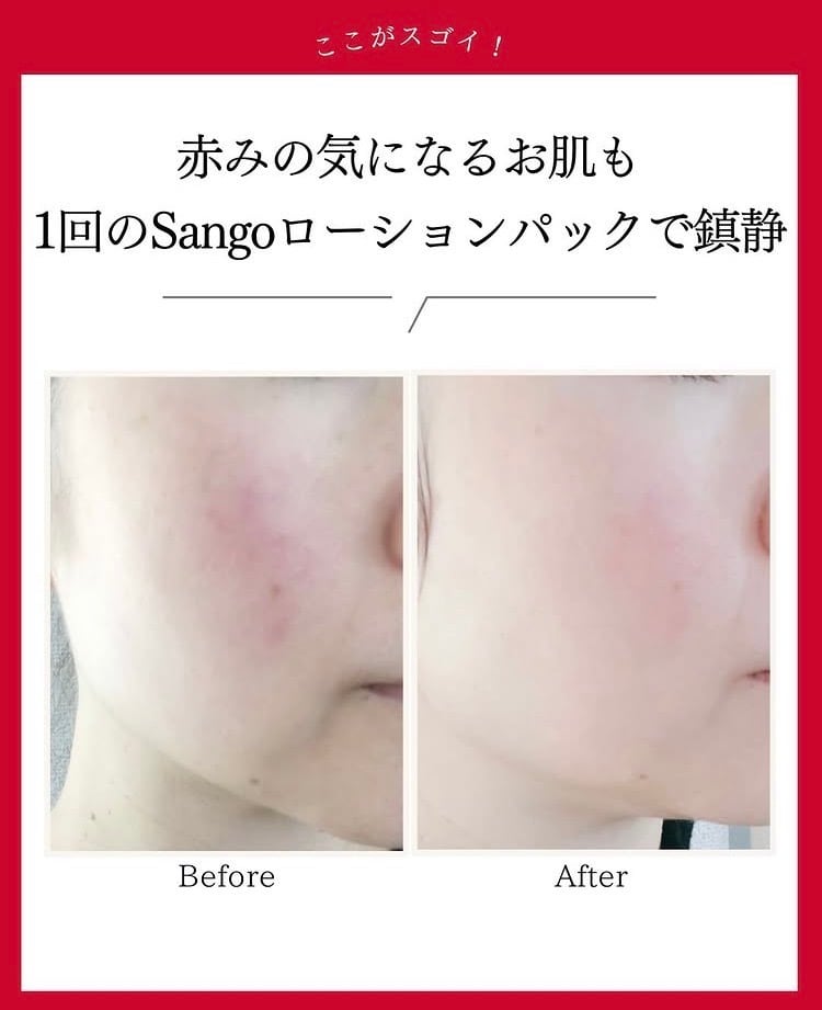 正規販売店】Sango（サンゴ）ローション｜ヒト幹で満たす浸透・保水