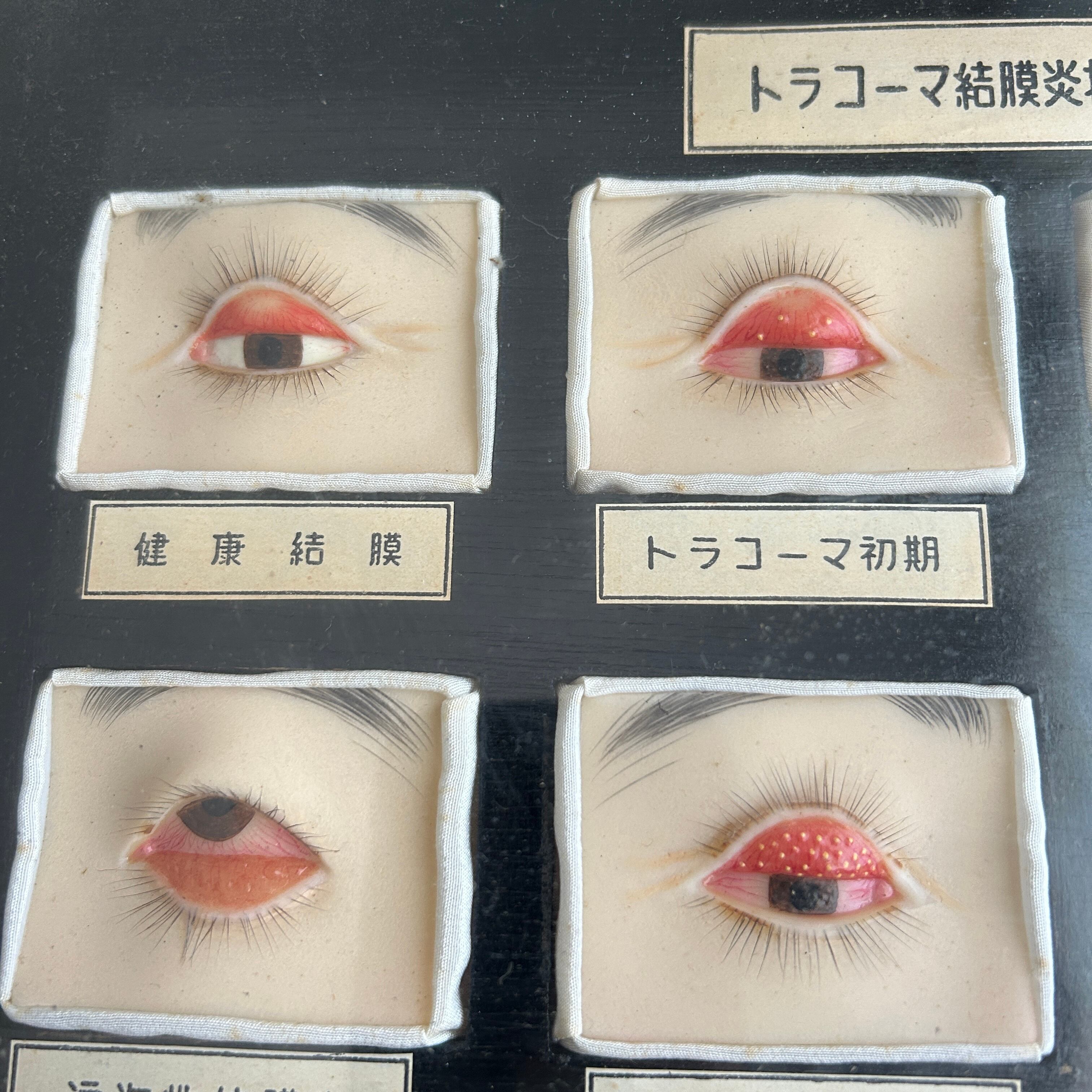 1950年代　眼科用結膜炎模型　