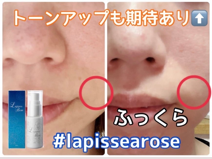 毎月の定期便】ずっと28％OFF＆送料無料LapsseaRose ラピシアローズ