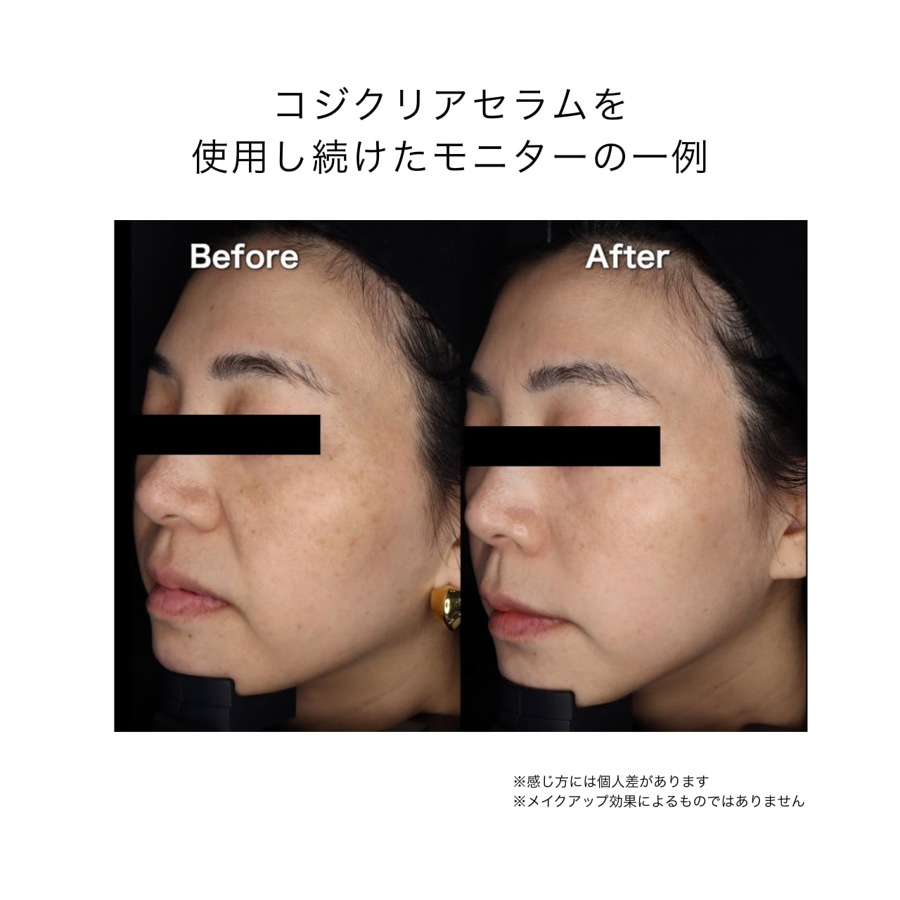 HAL SKIN ⁄ KOJICLEAR Serumの公式商品情報｜美容・化粧品情報はアット