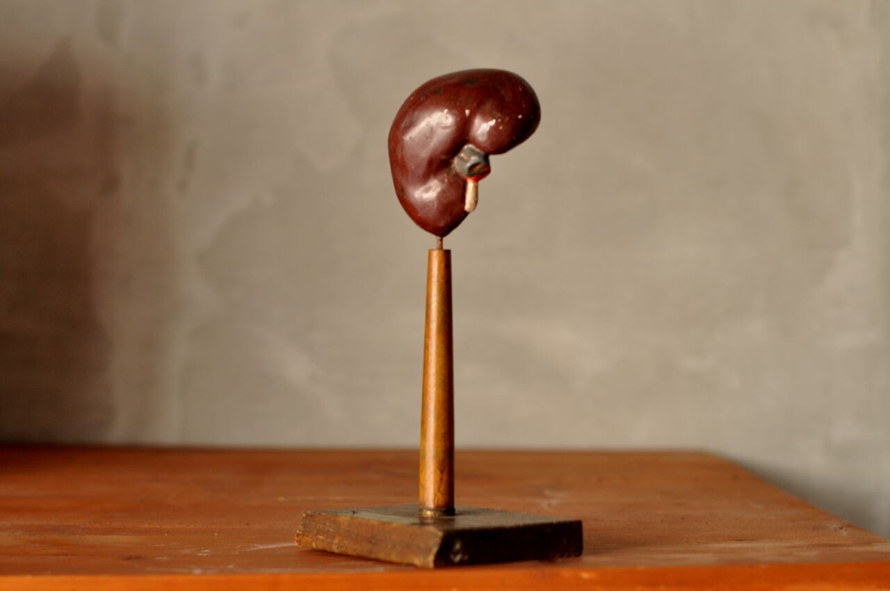 Human anatomical model(kidney)