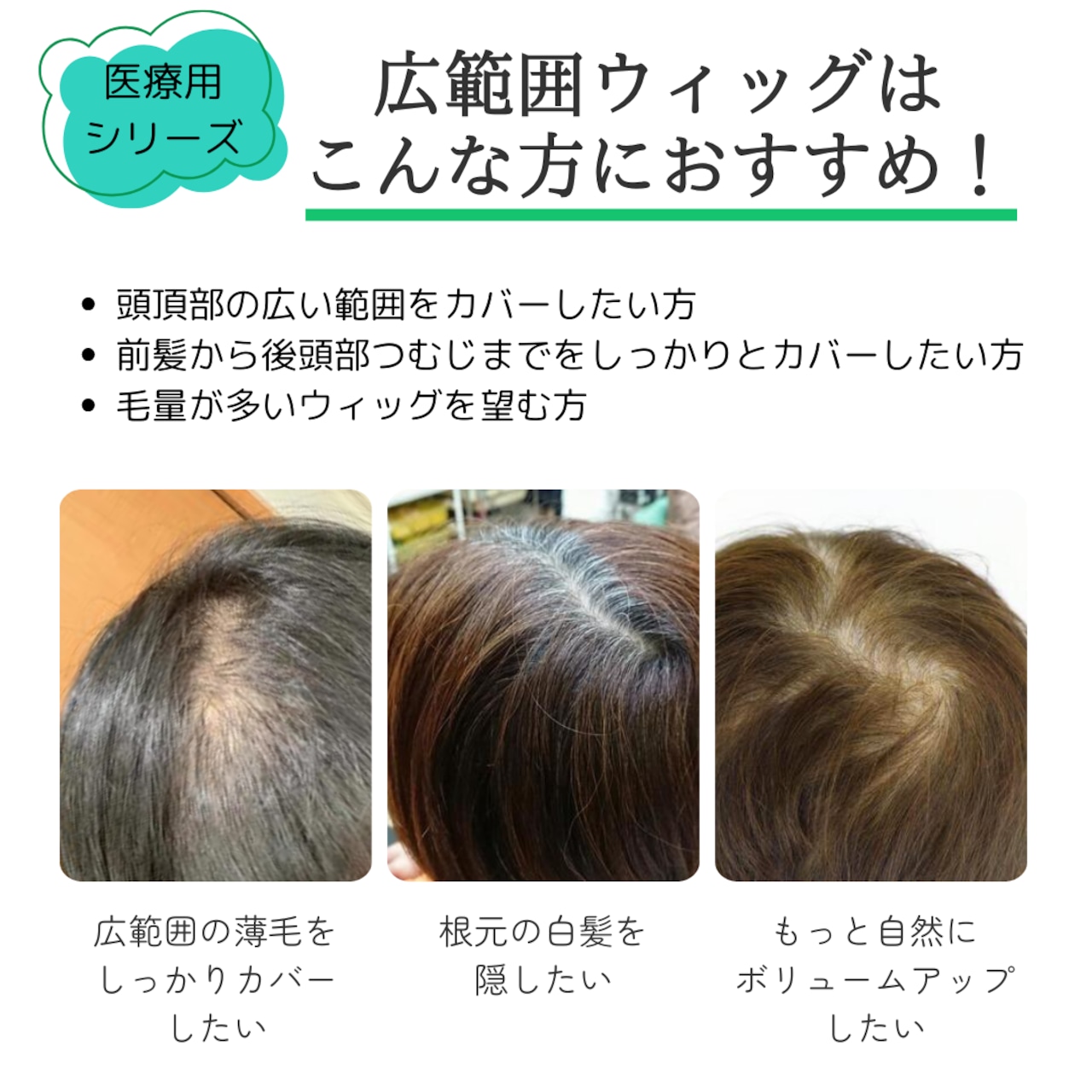 【試着・返品OK】人毛100% 広範囲カバーウィッグ ミディアムヘア トップピース 自然に見える 薄毛・白髪しっかりカバー【12×16cm】|ボリュームアップ - 7