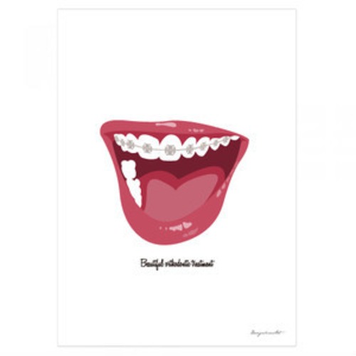Orthodontic　B3ポスター