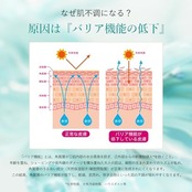 Anetos 22:00 アネトス バランシング トリートメントクリーム 水分保湿ケア 保湿感たっぷり ゆらぎ肌 オイリー肌 乾燥肌 スキンケア クリーム (50g)