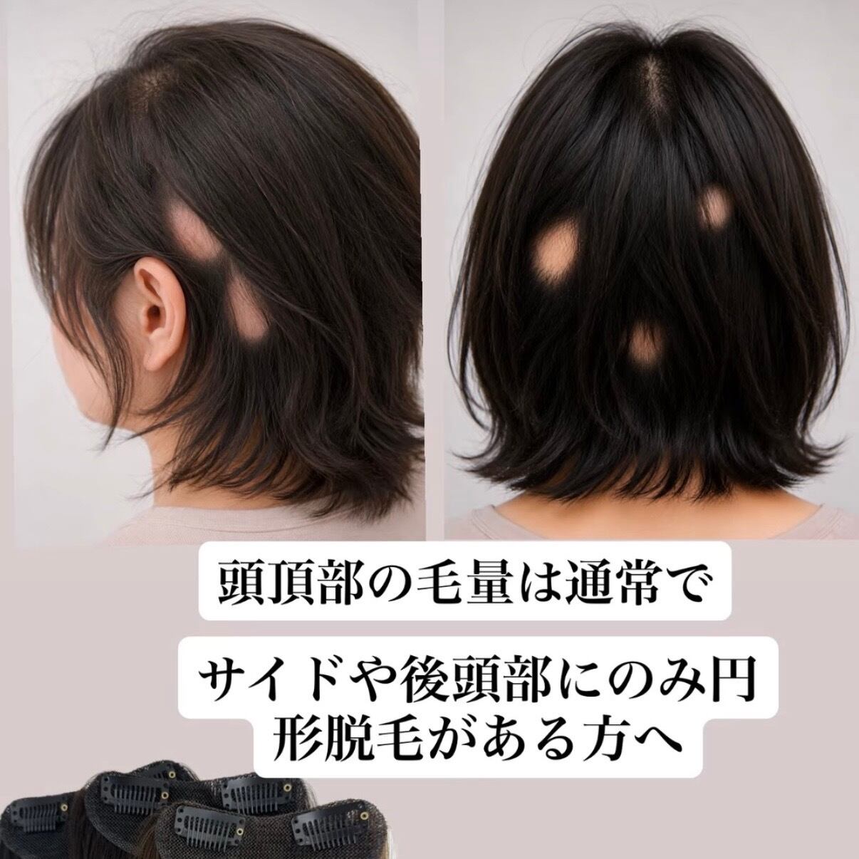 商品名:そら豆 オリジナル設計 ボリュームエクステ 2枚セット(髪留め