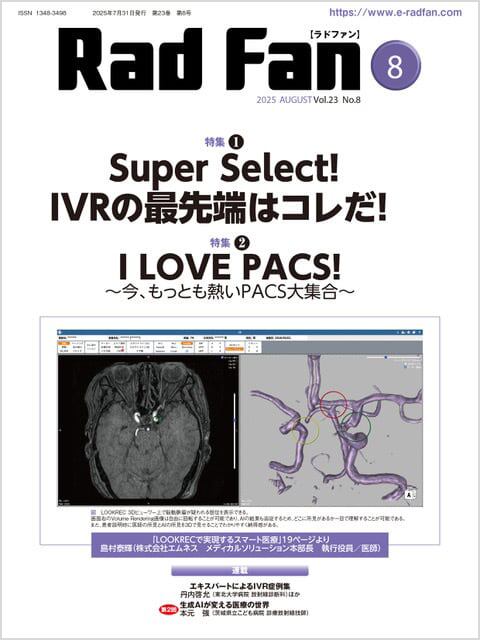 冠動脈の先を読み解く「心臓CT解析術」―心筋・機能・SHD・リスク評価の