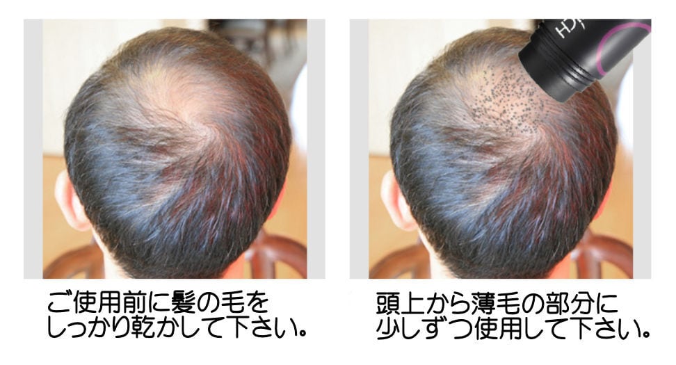 薄毛増毛ふりかけマイクロヘアパウダー詰め替え用 色ダークブラウン