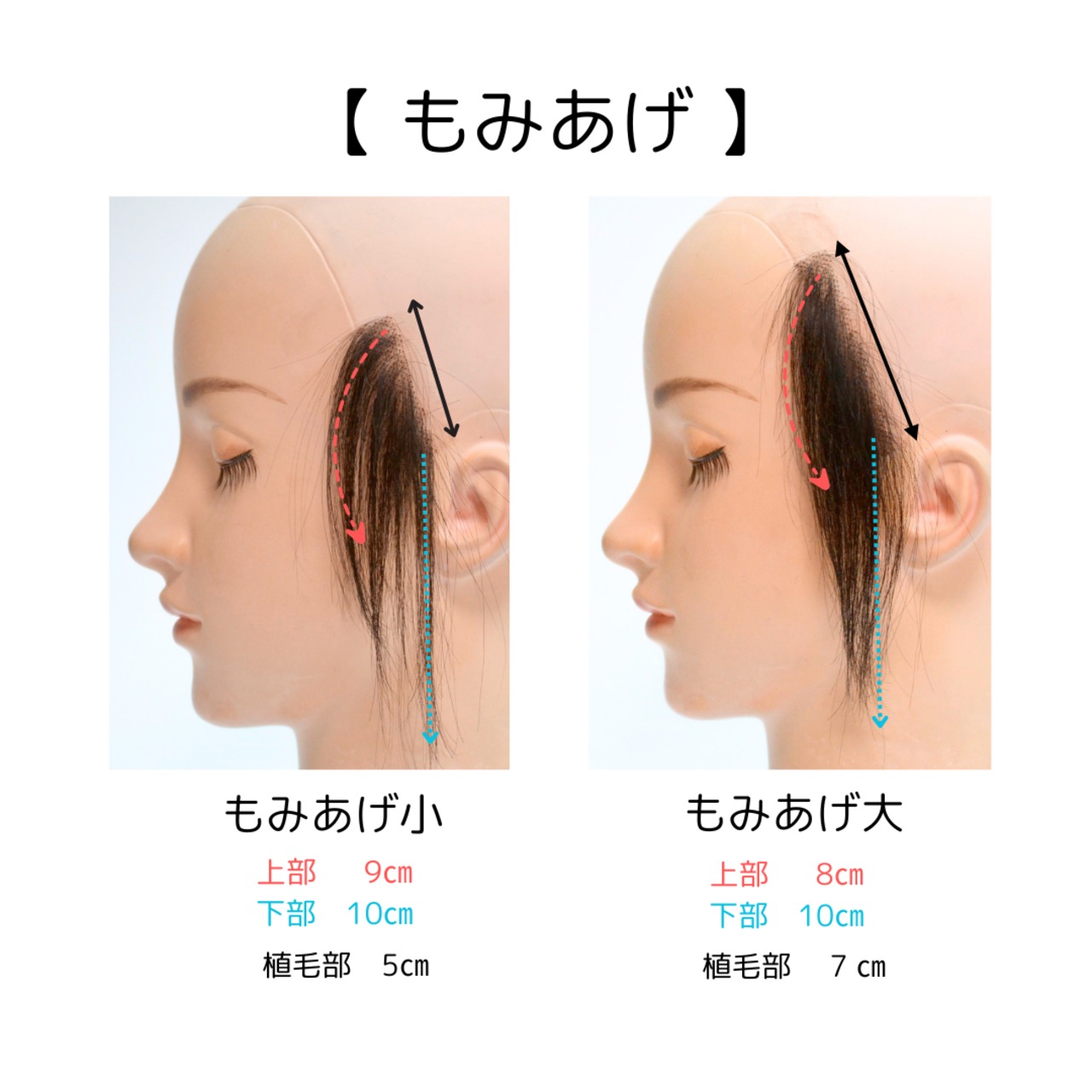 【医療用ウィッグ】人毛100％ もみあげウィッグ【左右ペアセット】｜さりげなフィット