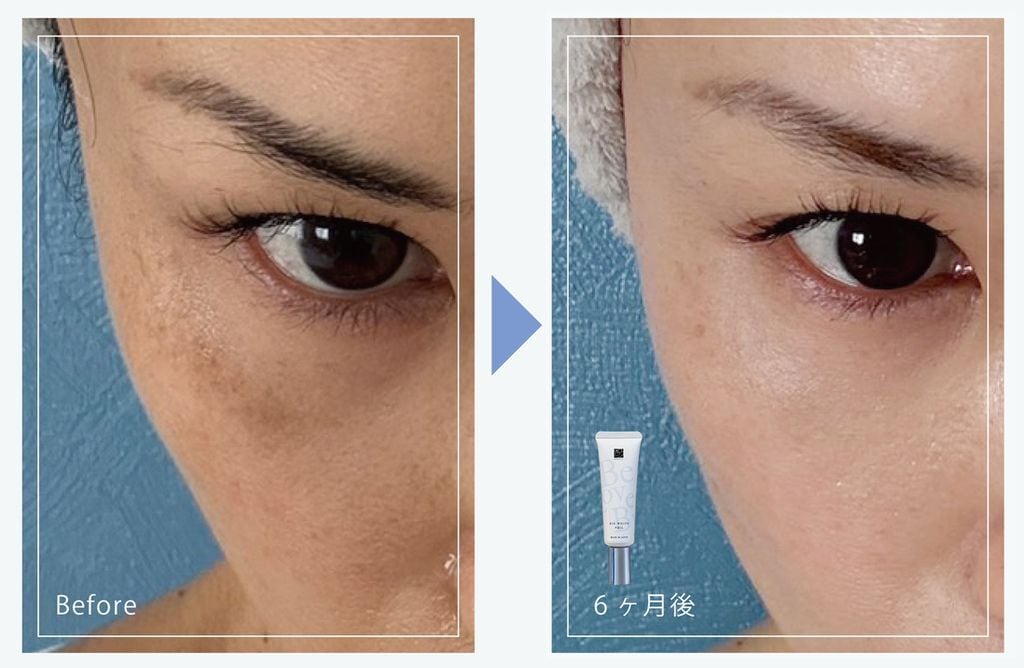 透明感を追求した美容液 リッドホワイトヴェール BeLovedBy