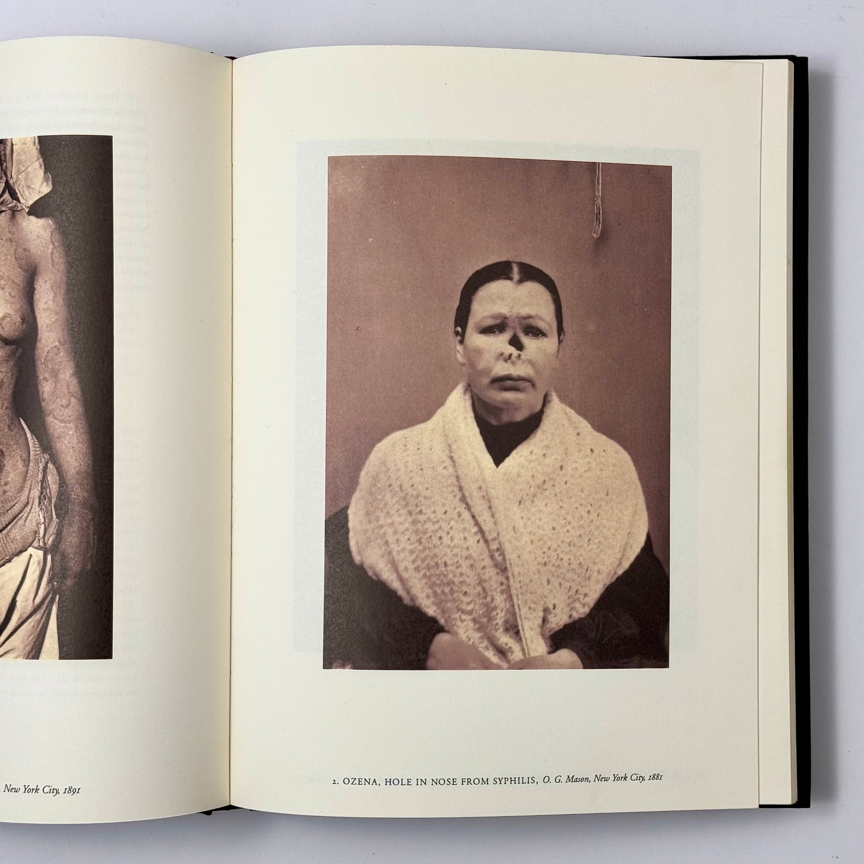 Harms Way: Lust & Madness, Murder & Mayhem／Joel-Peter Witkin