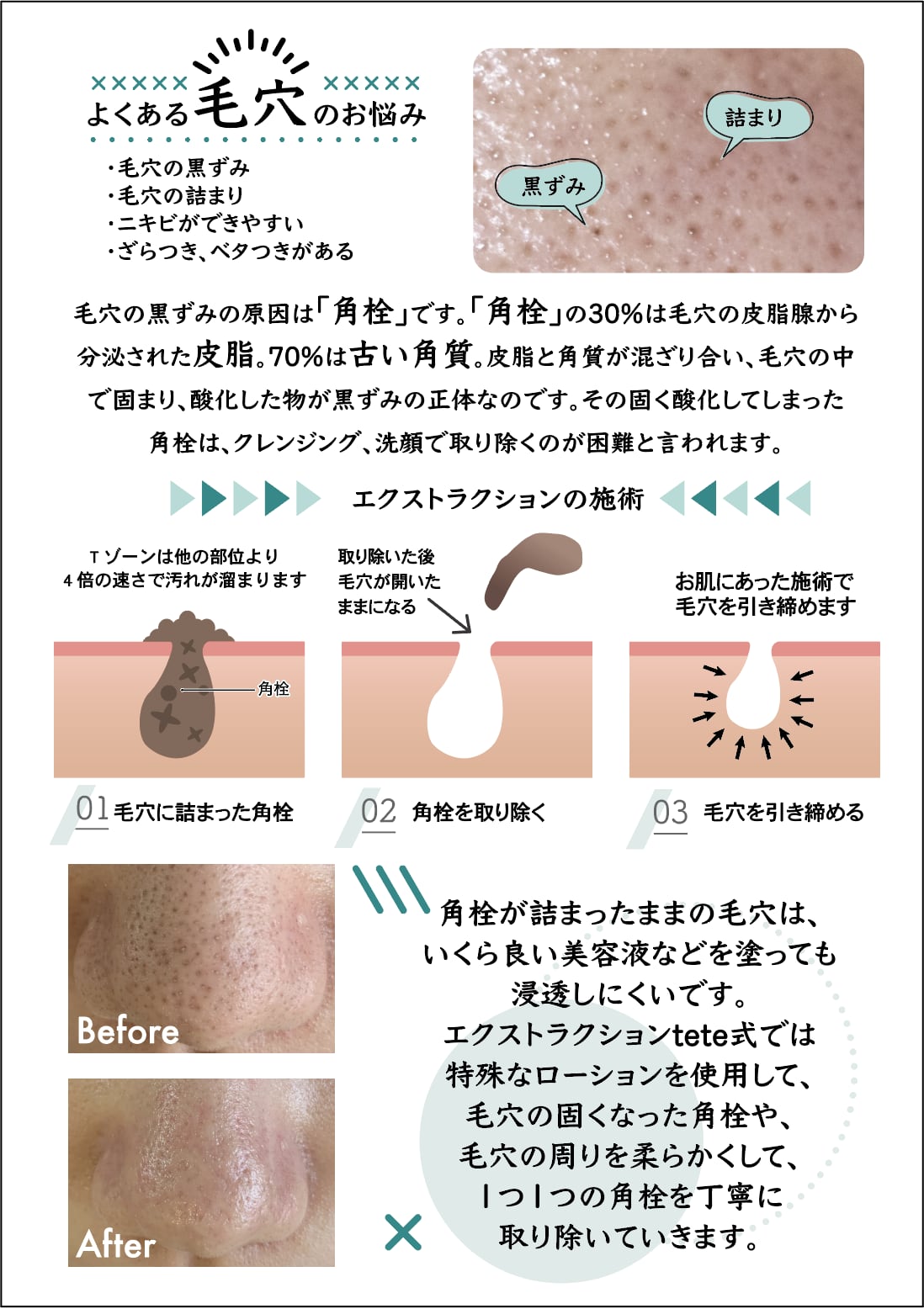 エクストキープミスト【毛穴ローション】｜tete | EMILUCA online store