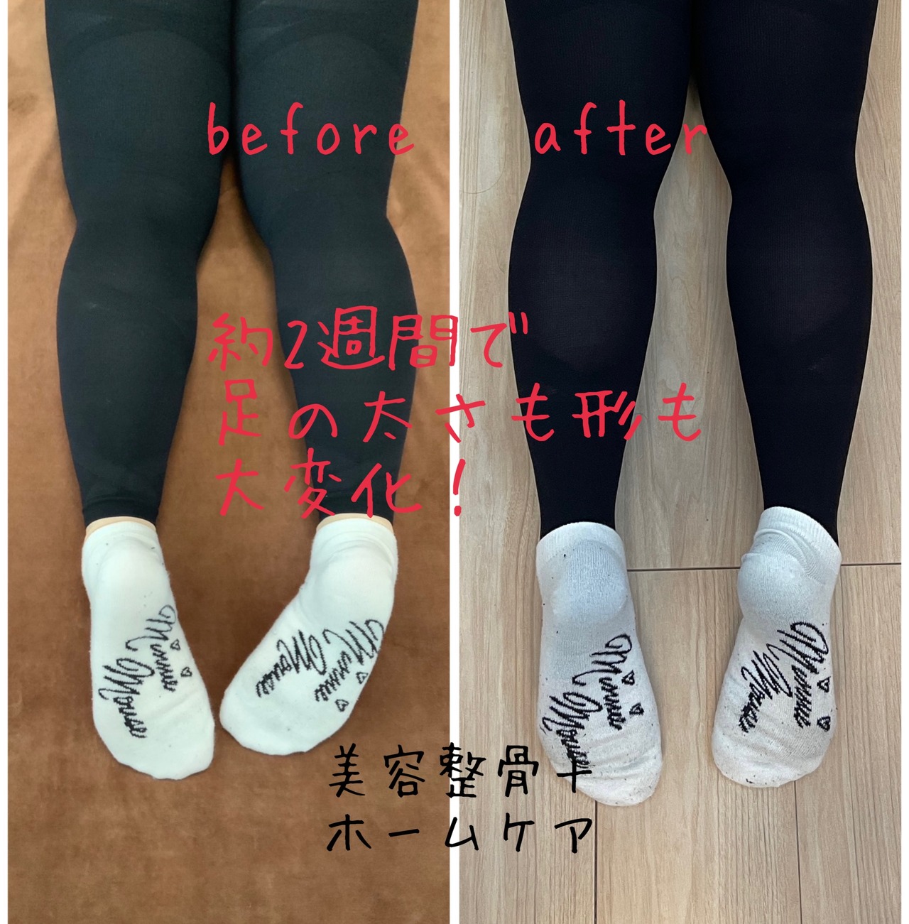 Mccoy〉ドルセットボディメイクレギンスL | 美容整骨 Rebone 福岡春日