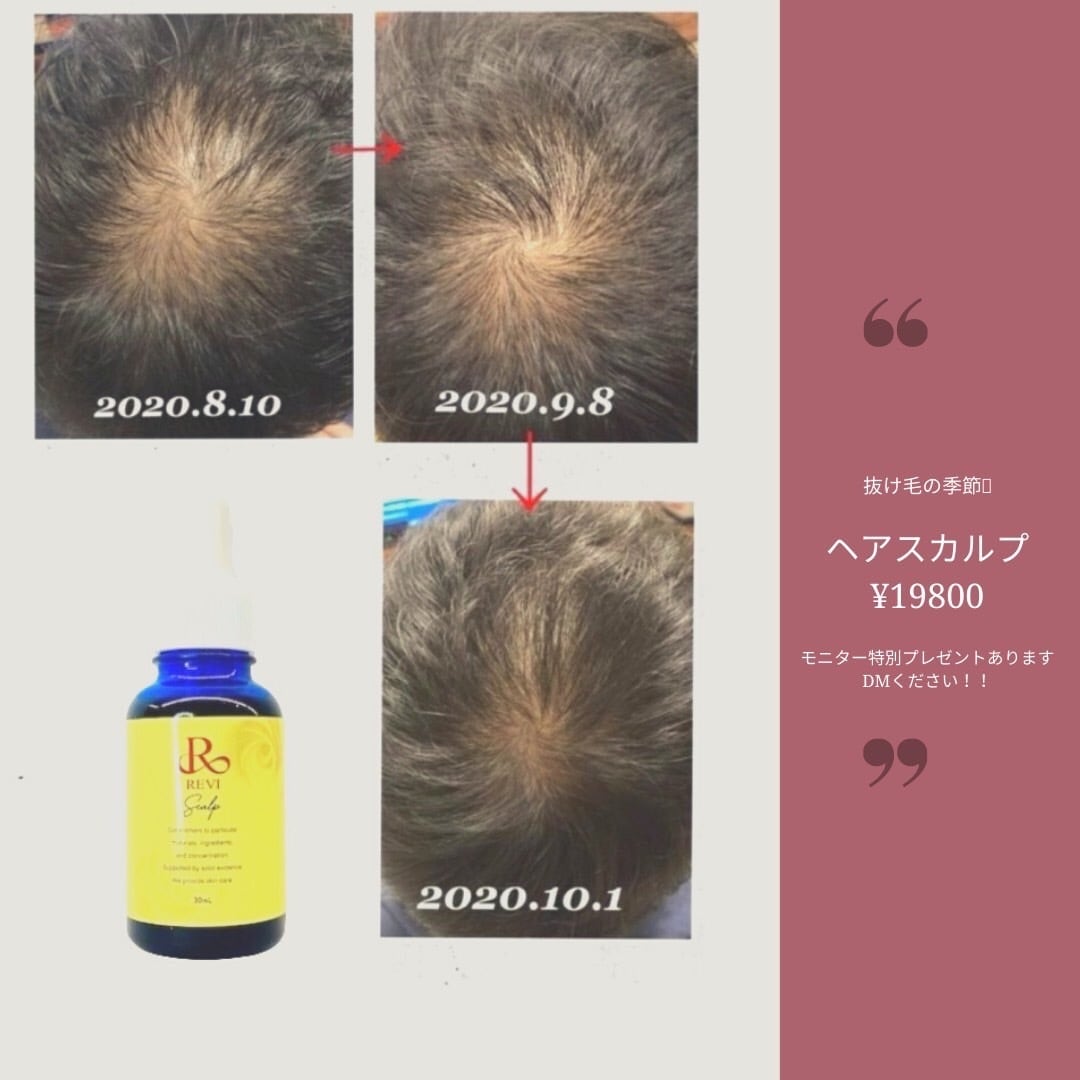 ルヴィ セルスカルプ 30ml 頭皮美容液 スカルプケア REVI