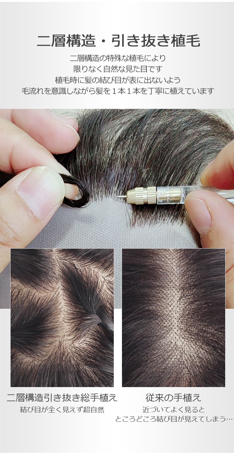 私元気！柔らかフィット通気性部分ウィッグ◎8×12cm髪の長さ20cm | fuwari