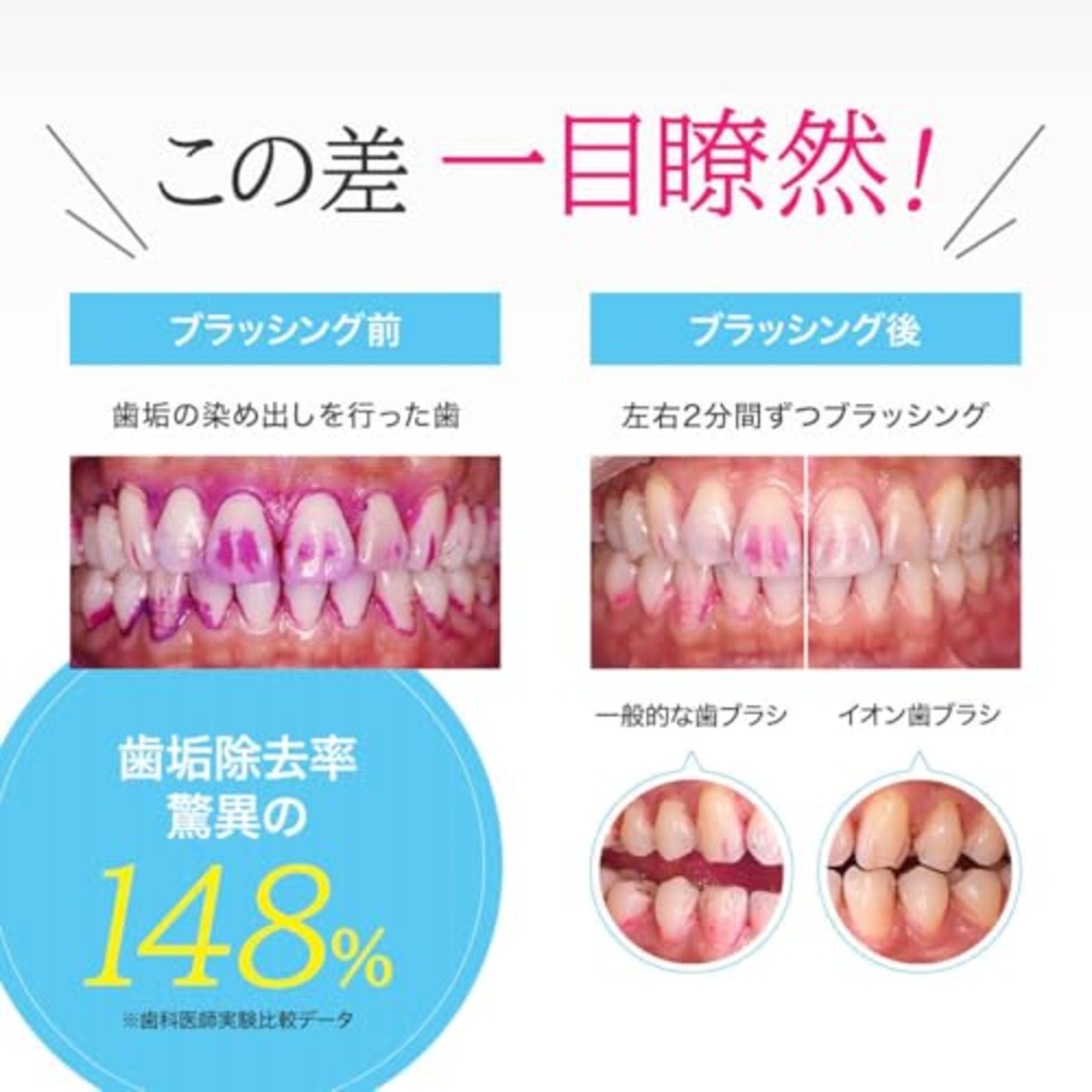 KISS YOU(キスユー) イオン歯ブラシ 山切レギュラー ふつう 替えブラシ (2本)