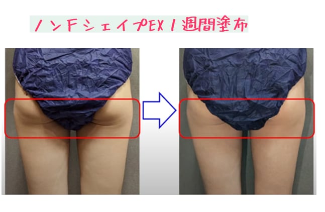 9f6fbc21fceca2ba33d8246251e43a