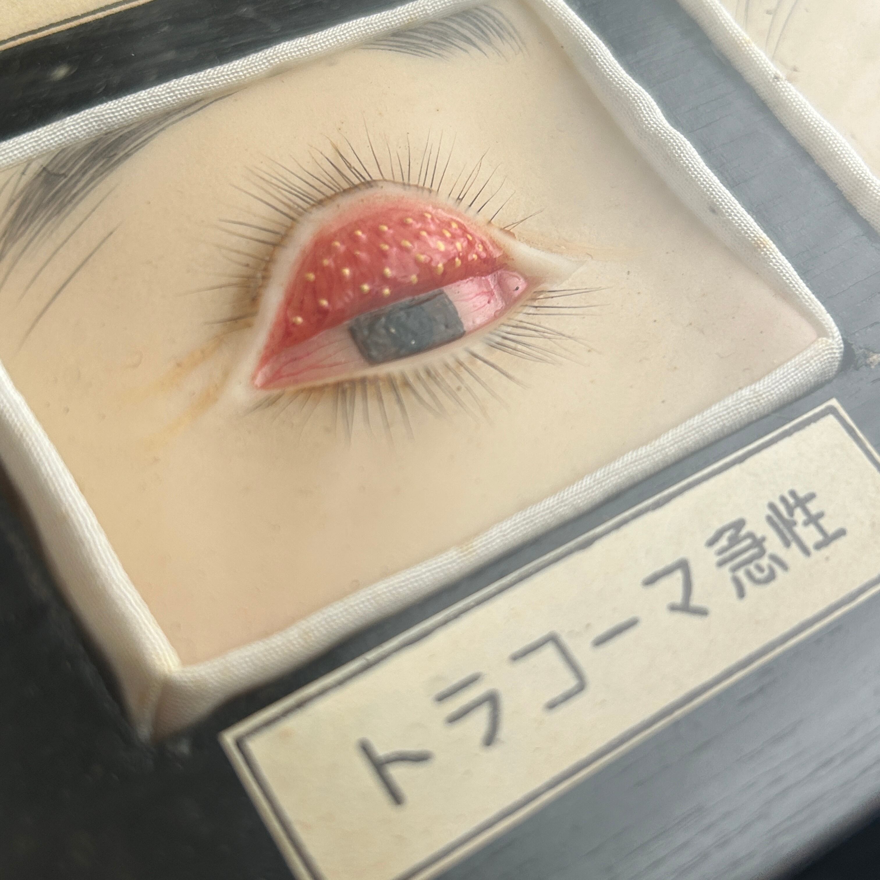 1950年代　眼科用結膜炎模型　