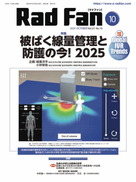 Rad Fan 14ー6 特集:造影CT 2016自慢のプロトコルとベスト症例 ITE [大型本] CT造影技術 | メディカルアイ・オンライン