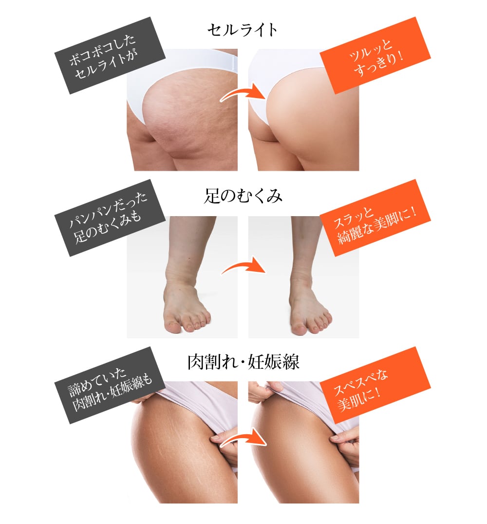 【美品】セルライトを撃退 セルライトを分解ドレナージュ❣️ヒートリテイン | サロン専売品