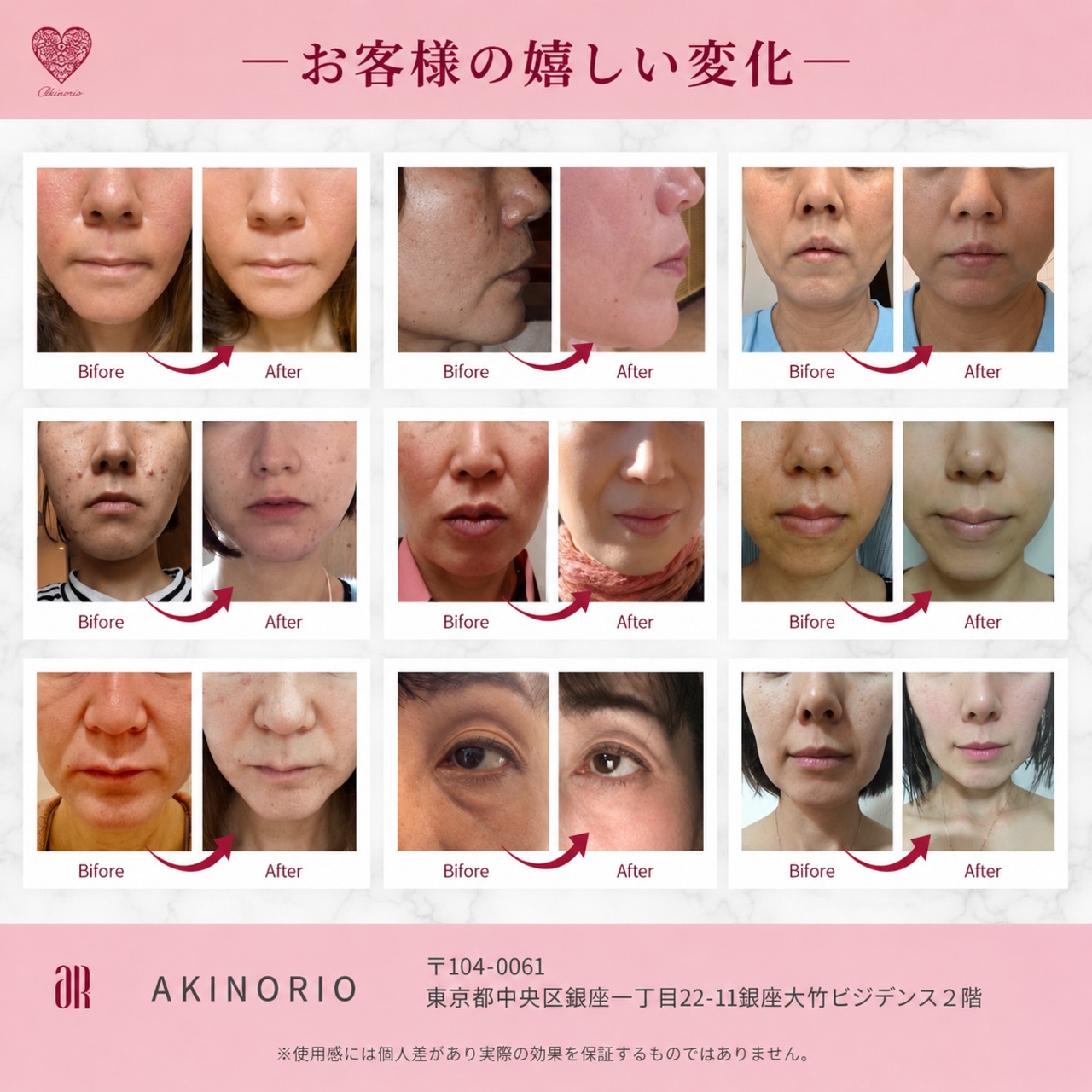 ミトコンドリアのちから｜AKINORIO 正規代理店 ROSÉQUA | ROSÉQUA