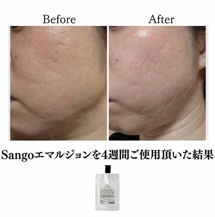 正規販売店】Sango（サンゴ）エマルジョン｜潤いを閉じ込め、ふっくら