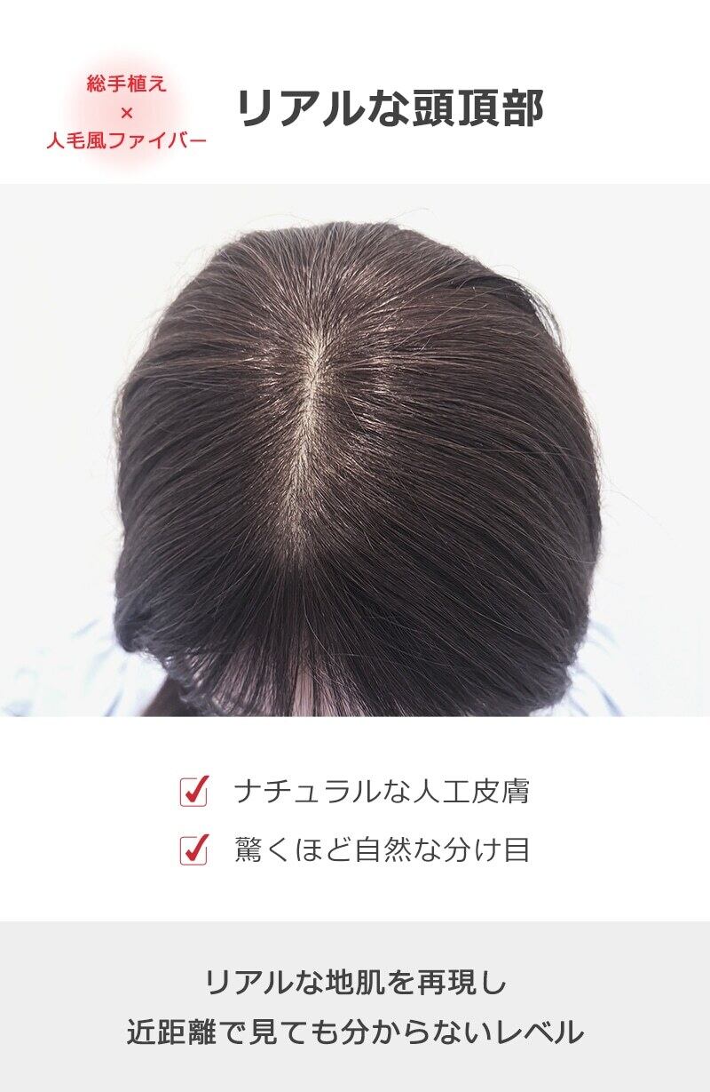 私元気！◎ 人毛風ファイバー総手植え部分ウィッグ9×14cmcm髪の長さ 