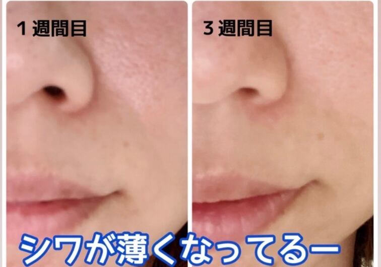 毎月の定期便】ずっと28％OFF＆送料無料LapsseaRose ラピシアローズ