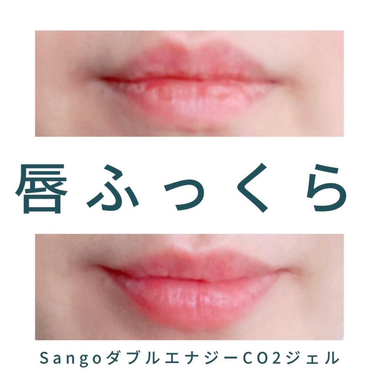Sango】ダブルエナジーCO2ジェル5回分(高濃度炭酸パック) | nemuriselect