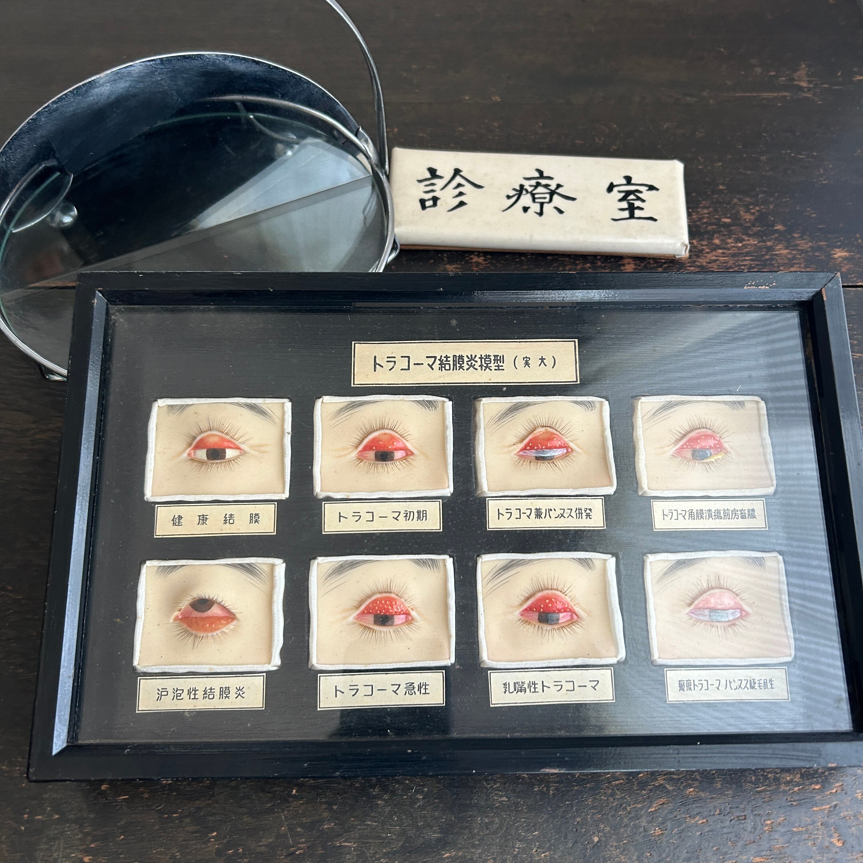 1950年代　眼科用結膜炎模型　