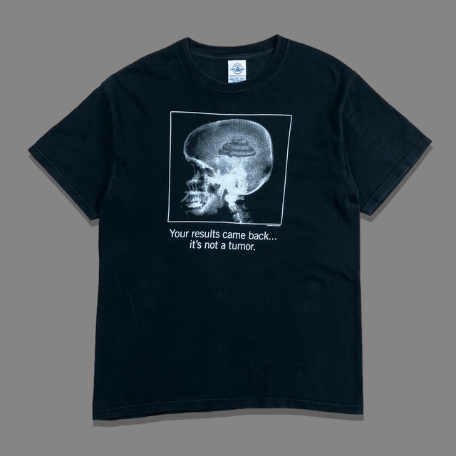 00s It’s Not a Tumor X-Ray Skull T-Shirt