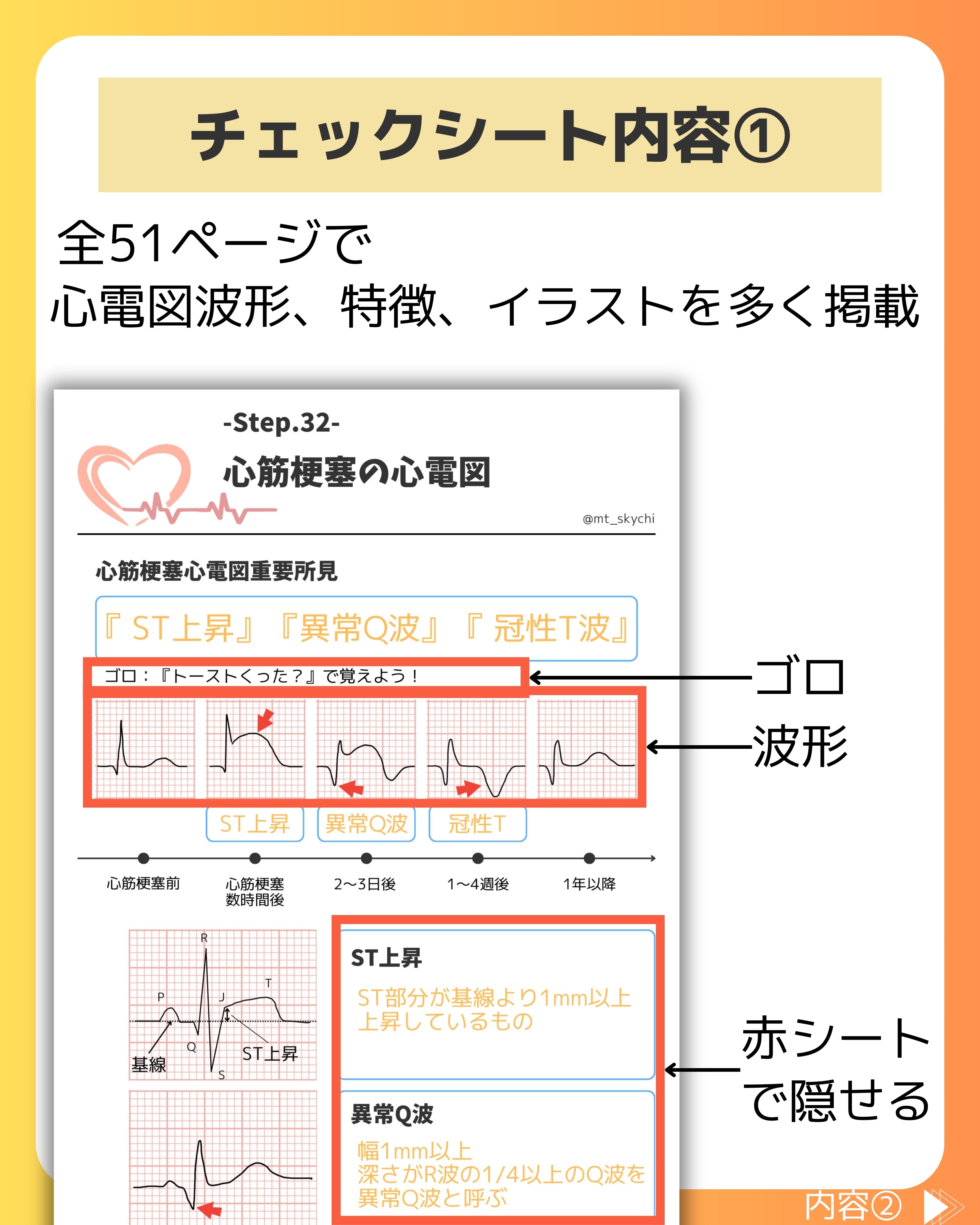 心電図初級編3,4級合格33ステップ+模試(PDF版) | そらち/臨床検査技師