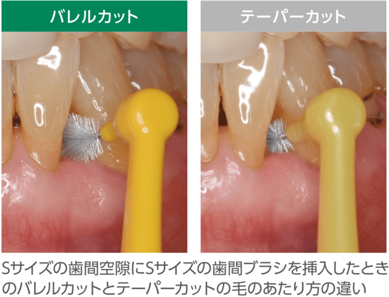 GUM・プロズ 歯間ブラシ バレルカット(4本入)