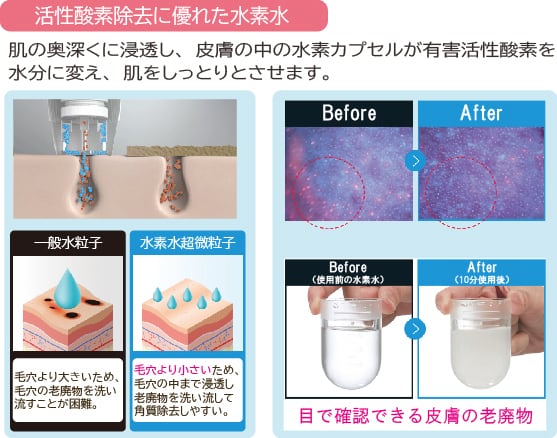 未開】毛穴洗浄 吸引 水素ウォータークレンジング ハイドロワン