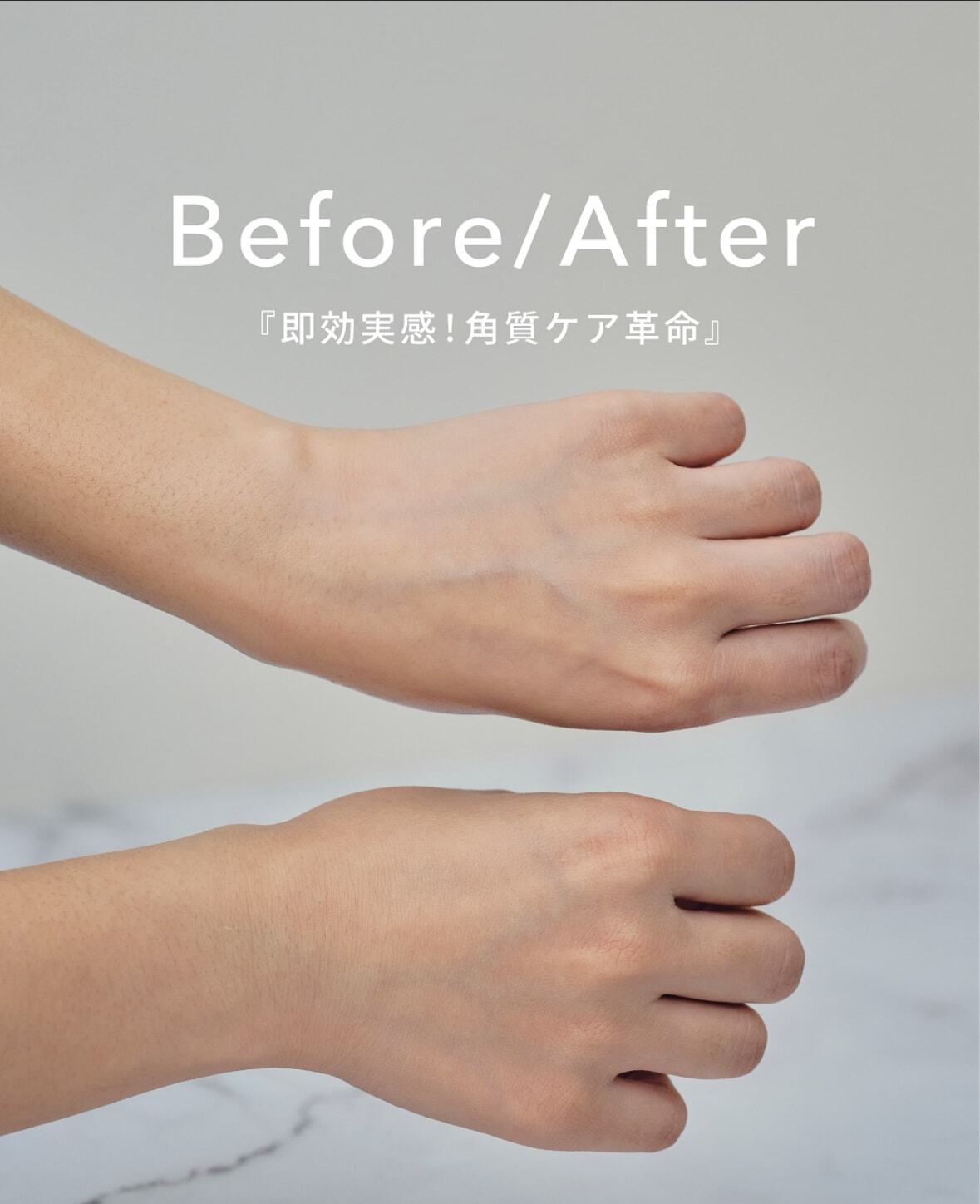 ぶるち】【水光肌管理】LADAMER ピーリングピンプルパッド30枚 | The