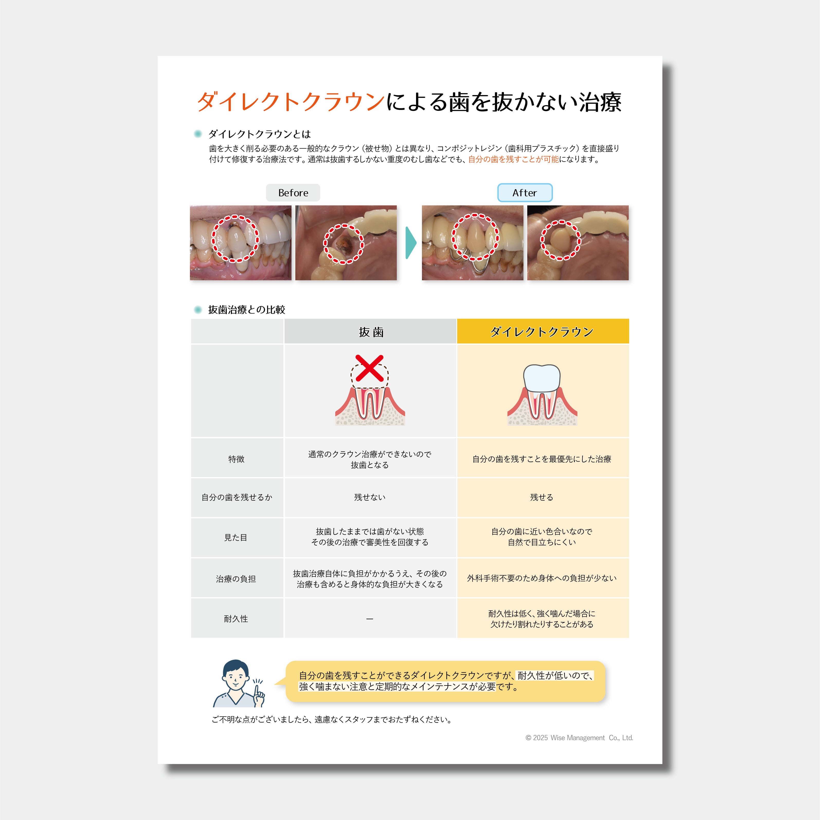 【データ販売】ダイレクトクラウンによる歯を抜かない治療