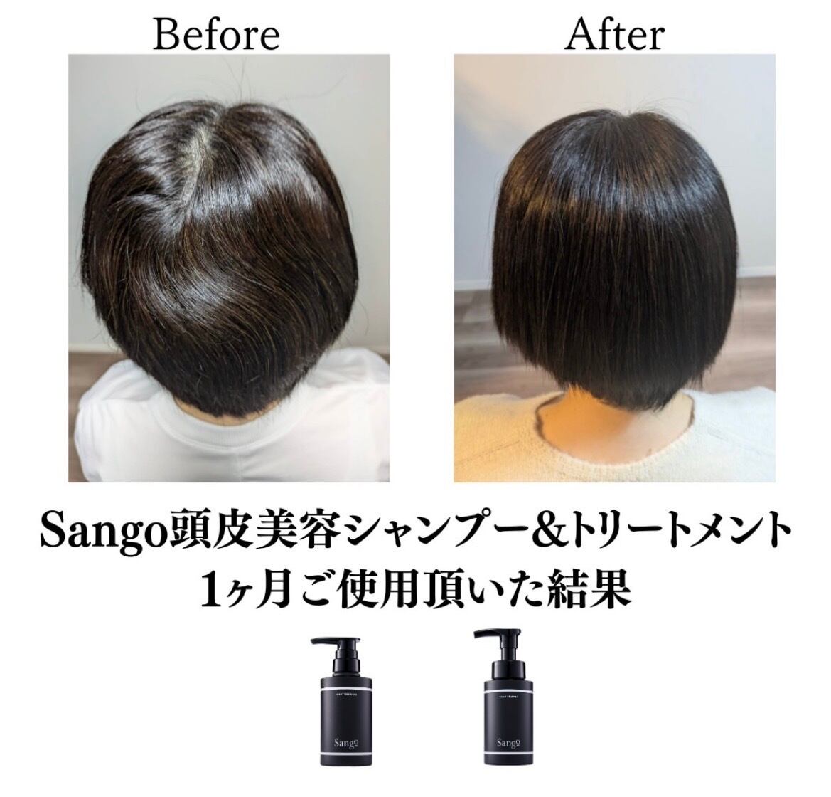 ヘアケア Sangoヒト幹細胞頭皮美容シャンプー Sango育毛ヘアシャンプー