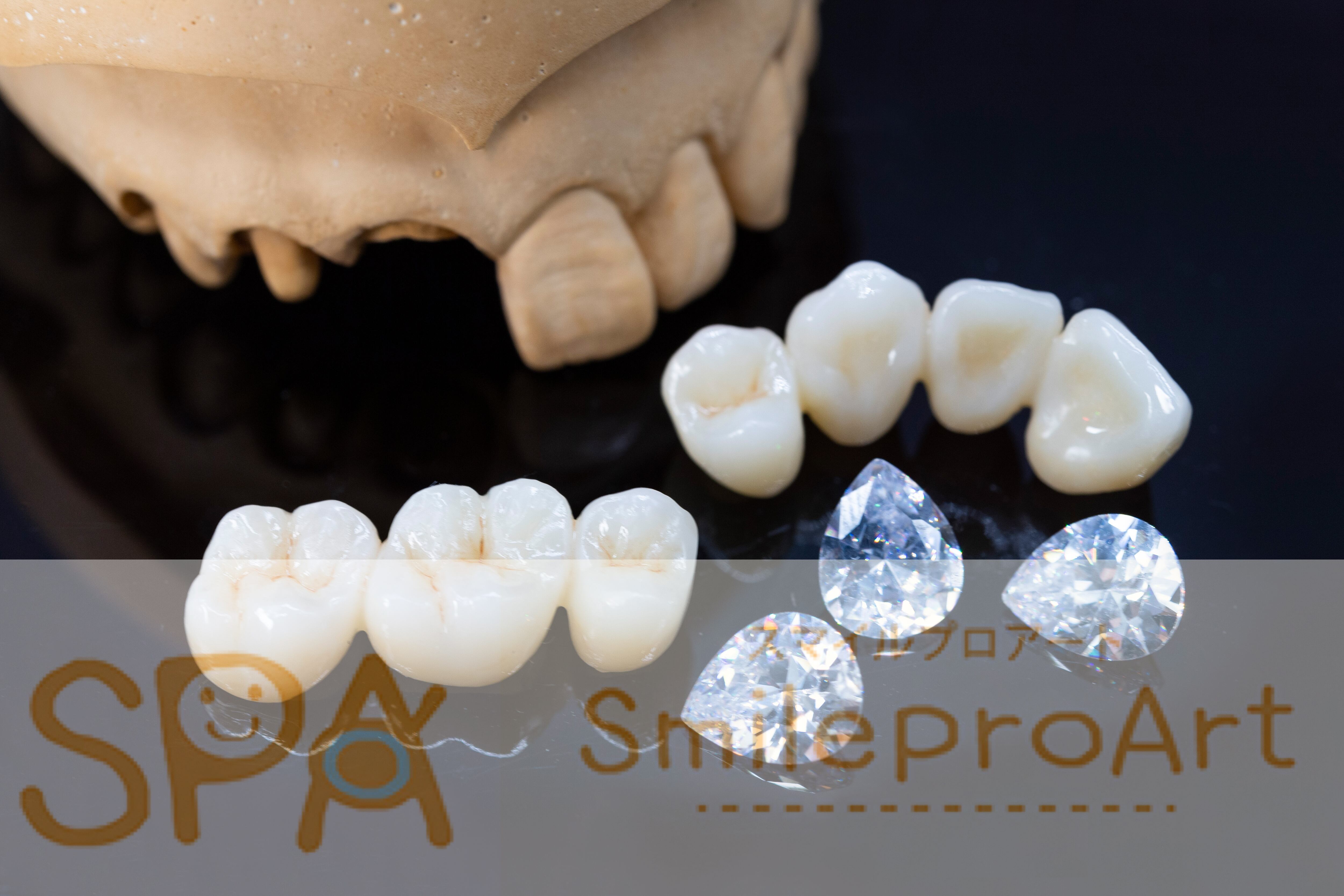 ジルコニアクラウン/ Zirconia crown Dental stock