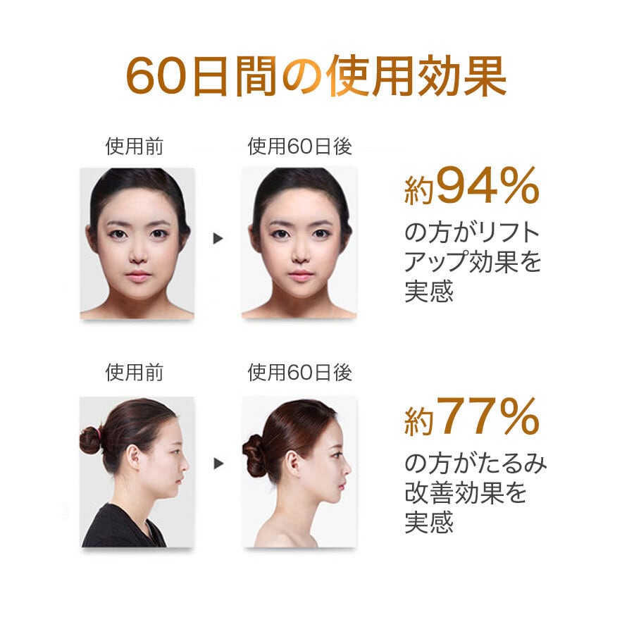 小顔美肌 電動美顔ローラー 美顔器 24Kゴールド エステ スキンケア