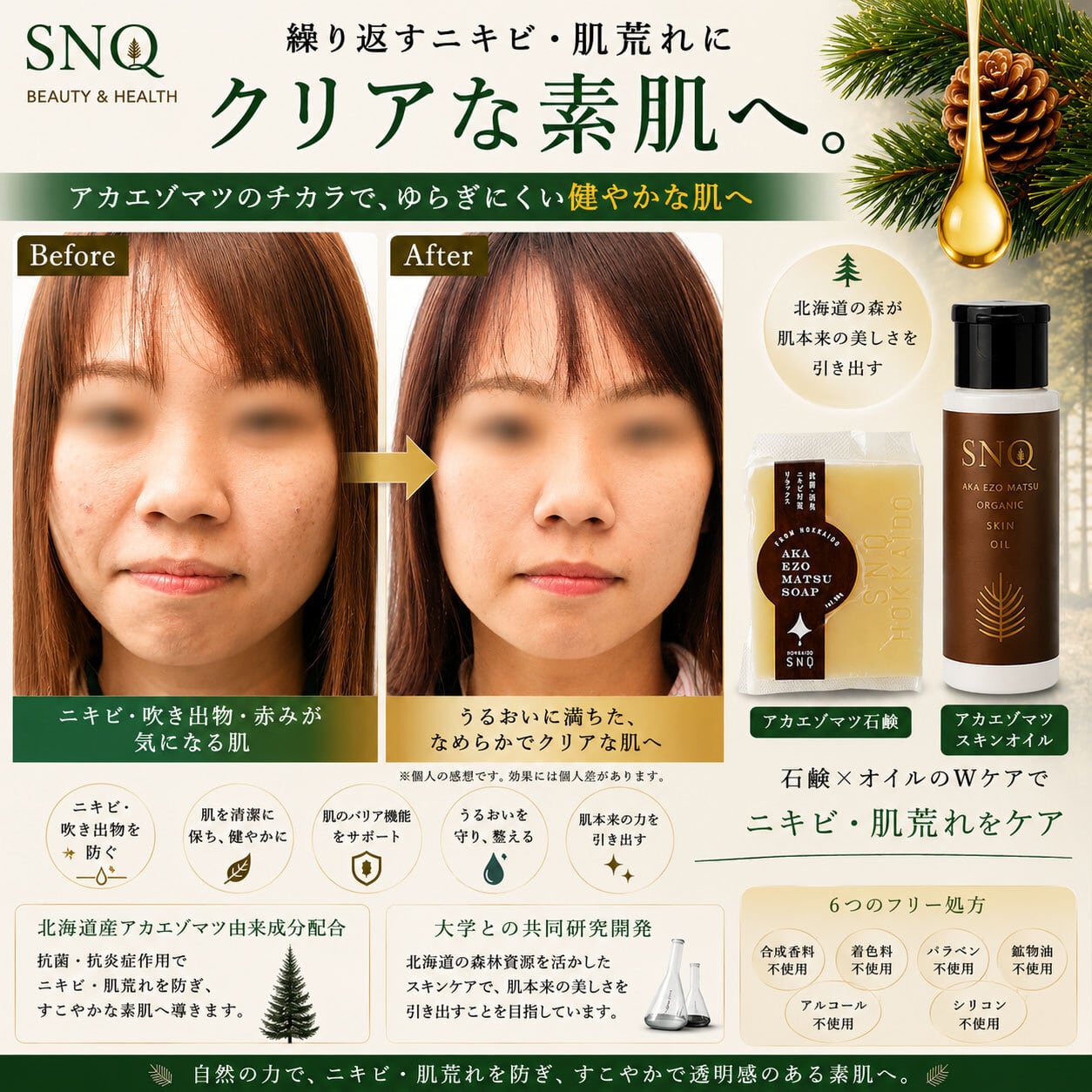 人用】 “やさしく洗い、うるおい守る” SNQ オーガニック アカエゾマツ