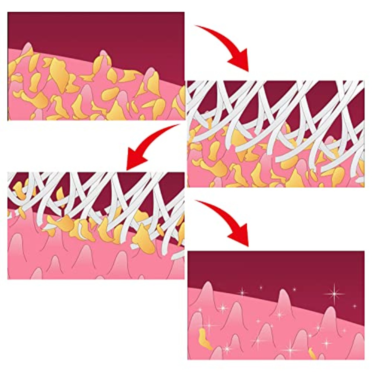 舌ブラシ W-1 (ダブルワン) (色はおまかせ)