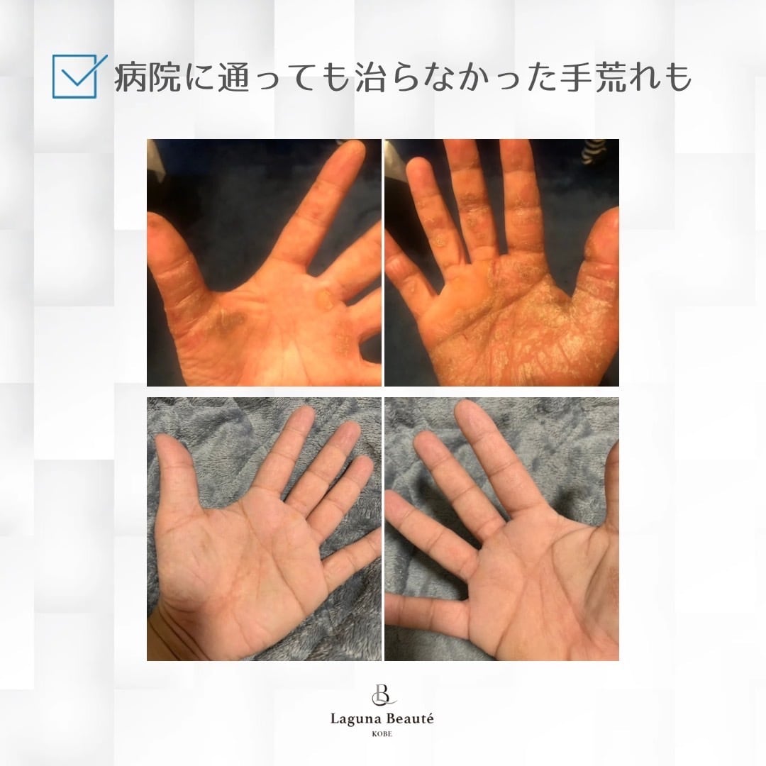 LUMINARIVA BOOSTER MIST（ルミナリヴァ） 東京大学共同研究/アトピー