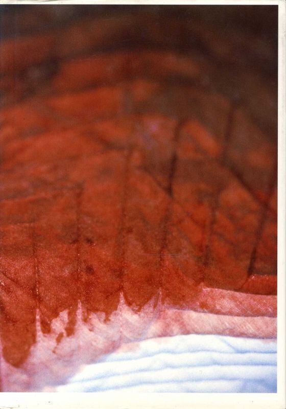 目のまえのつづき