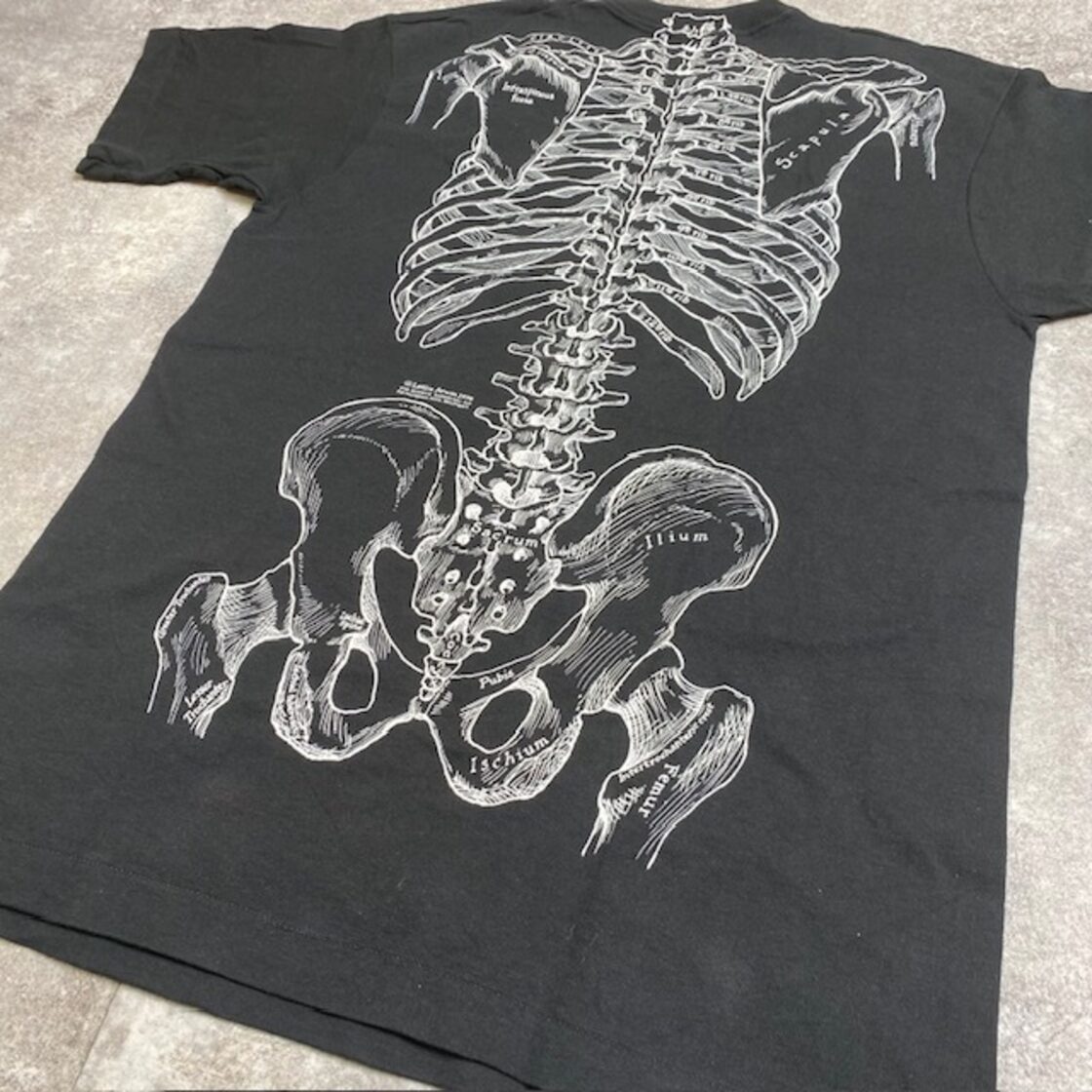 90