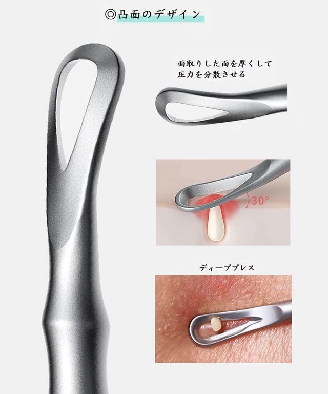 Dorake 角栓ピンセット 精密ピンセット 極細先端 角栓取り かくせんとり ニキビ取り 熱処理済み 精密な作業が可能 収納ケース付き 2本セット