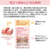 ニチバン 傷あとケア用品 アトファイン 傷あとケアテープ Lサイズ 50mm×164mm ATFL