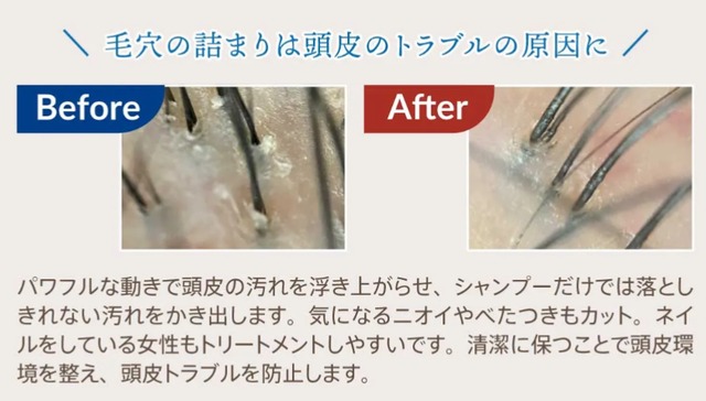 ZOGANKIN SCALP（ゾーガンキンスカルプ） | ERB株式会社